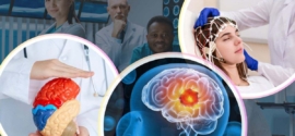 How To Contact Best Neurologist in Hyderabad